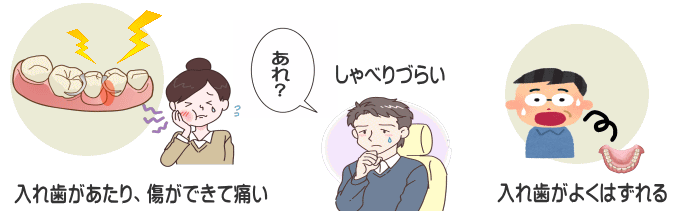 千葉市・四街道市の歯医者さん、入れ歯が安定していない可能性があります
